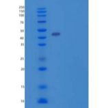人ACADM/MCAD重组蛋白N-6His
