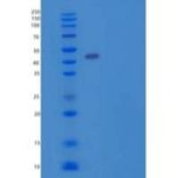 人ACADM/MCAD重组蛋白N-6His