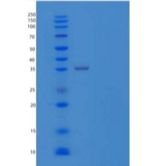 人含CUB结构域的蛋白1重组蛋白
