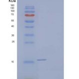 人同种异体移植炎性因子1/AIF1重组蛋白C-6His
