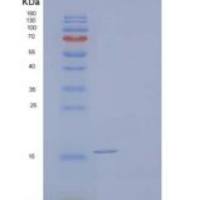 人同种异体移植炎性因子1/AIF1重组蛋白C-6His