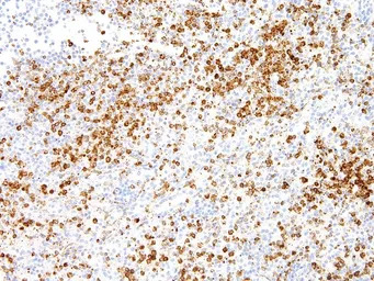 Annexin A1 antibody [IHC512]