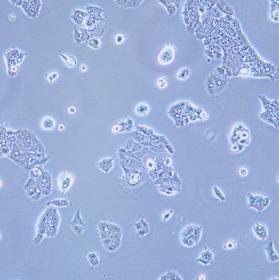 HPAF-II 人胰腺癌细胞/STR鉴定/镜像绮点（Cellverse）