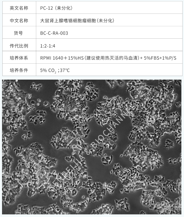 我不允许还有人分不清PC-12未分化、低分化、高分化