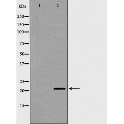 CDKN1A Antibody