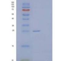 人磷酸核酮糖3-差向异构酶重组蛋白