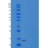 人小泛素相关修饰物1重组蛋白