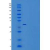 小鼠同源盒蛋白Hox-B4/HOXB4/HOX-2F重组蛋白N-6His