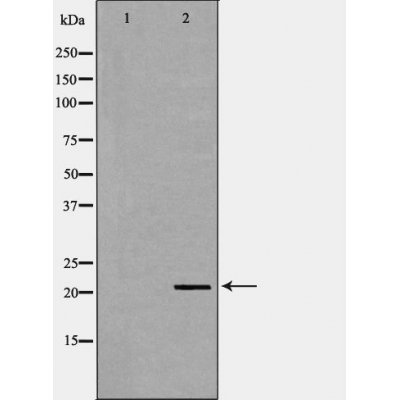 TDGF1 Antibody