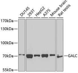 Galactosylceramidase antibody