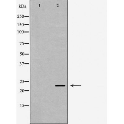 LCN2 Antibody