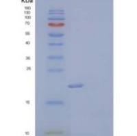 小鼠Fms样酪氨酸激酶3配体/FLT3LG重组蛋白C-6His