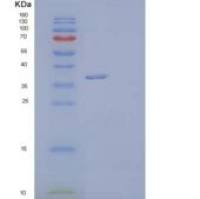 人Dickkopf相关蛋白3(DKK3)重组蛋白C-6His