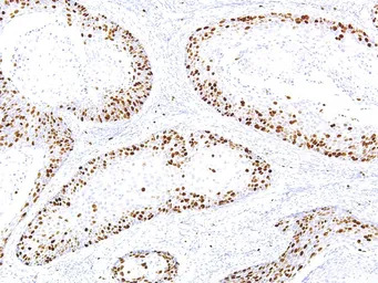 Ki67 antibody [IHC067]
