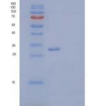 人VIP36样蛋白/LMAN2L重组蛋白C-6His
