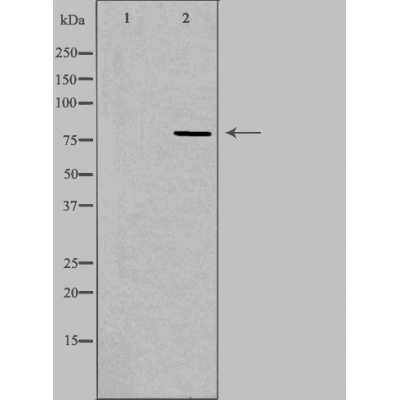 CEP78 Antibody