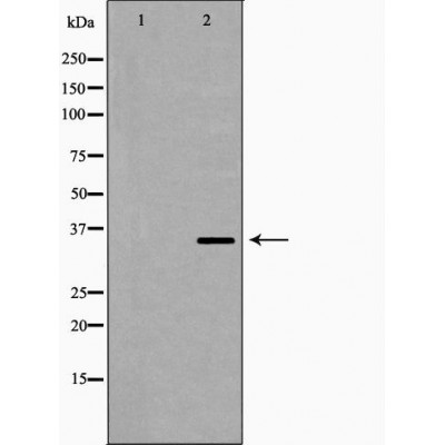 PPP2CB Antibody