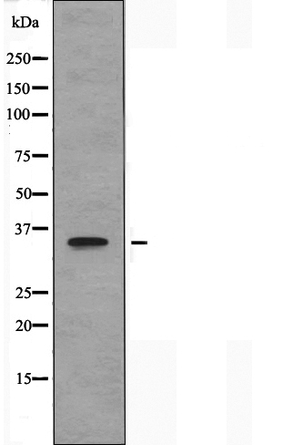 TAS2R13 Antibody