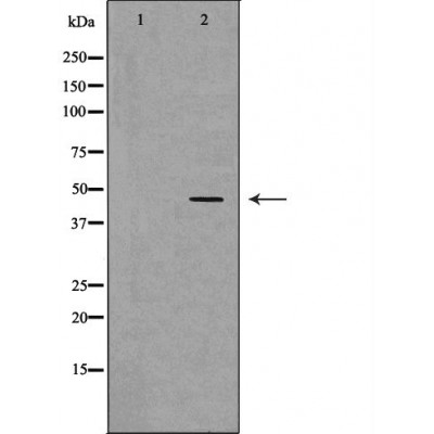NGFR Antibody