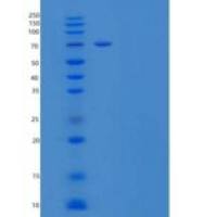 人血浆激肽释放酶/KLKB1重组蛋白C-6His