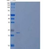 人干扰素λ-2/白介素-28A重组蛋白C-6His