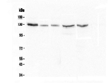 CASR Antibody (monoclonal, 11E