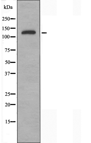 ADAMTS19 Antibody