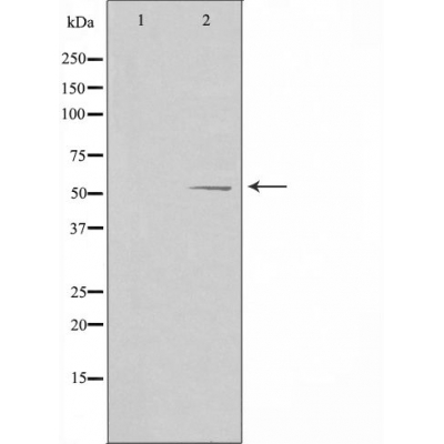 ALDH1B1 Antibody