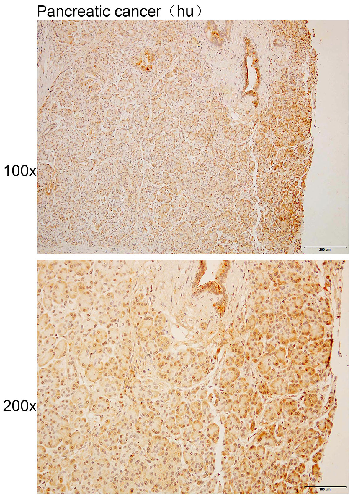 Anti-CASP10 Polyclonal Antibod