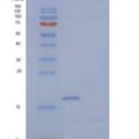 人脂肪酸结合蛋白3重组蛋白