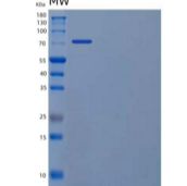 人磷酸果糖激酶1/PFKM/PFKX重组蛋白C-6His