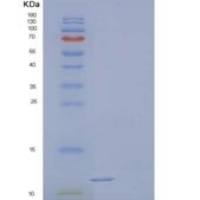 人Podoplanin/PDPN/Aggrus重组蛋白C-6His