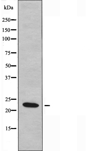 NMU Antibody