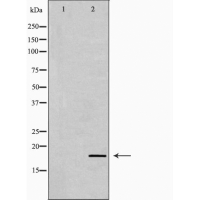 IL2 Antibody