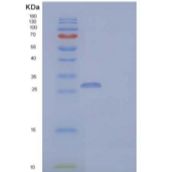 人Coronin-6/CORO6重组蛋白N-6His