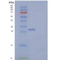 人Coronin-6/CORO6重组蛋白N-6His