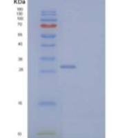 人内质网驻留蛋白27重组蛋白
