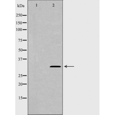 SDC1 Antibody