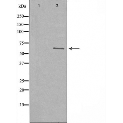 B-RAF Antibody