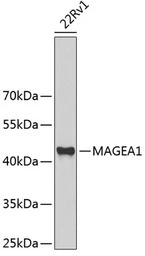 MAGE 1 antibody