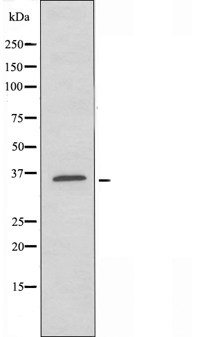 AKR1C2 Antibody