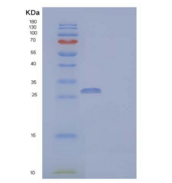 人Coronin-6/CORO6重组蛋白N-6His