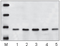Western blot预染蛋白Marker(19～110kDa)应用实例