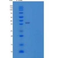 人网状蛋白-3(Reticulocalbin-3)重组蛋白