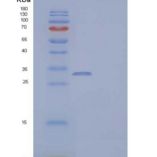 人白介素-12亚单位β/白介素-12 p40/白介素-12B重组蛋白