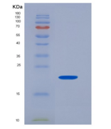 人CD32a / FCGR2A重组蛋白166 Arg, Hi