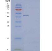 人脱氧羟脯氨酸合酶/DHS重组蛋白C-6His