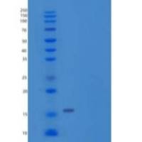 人40S核糖体蛋白S19(RPS19)重组蛋白