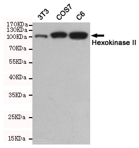 Hexokinase II Mouse mAb