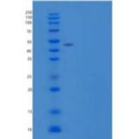 人核仁蛋白3(NOL3)重组蛋白N-GST